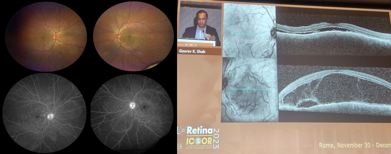 Immagine che contiene lastra dei raggi X, Imaging medicale, radiologia, schermata Descrizione generata automaticamente