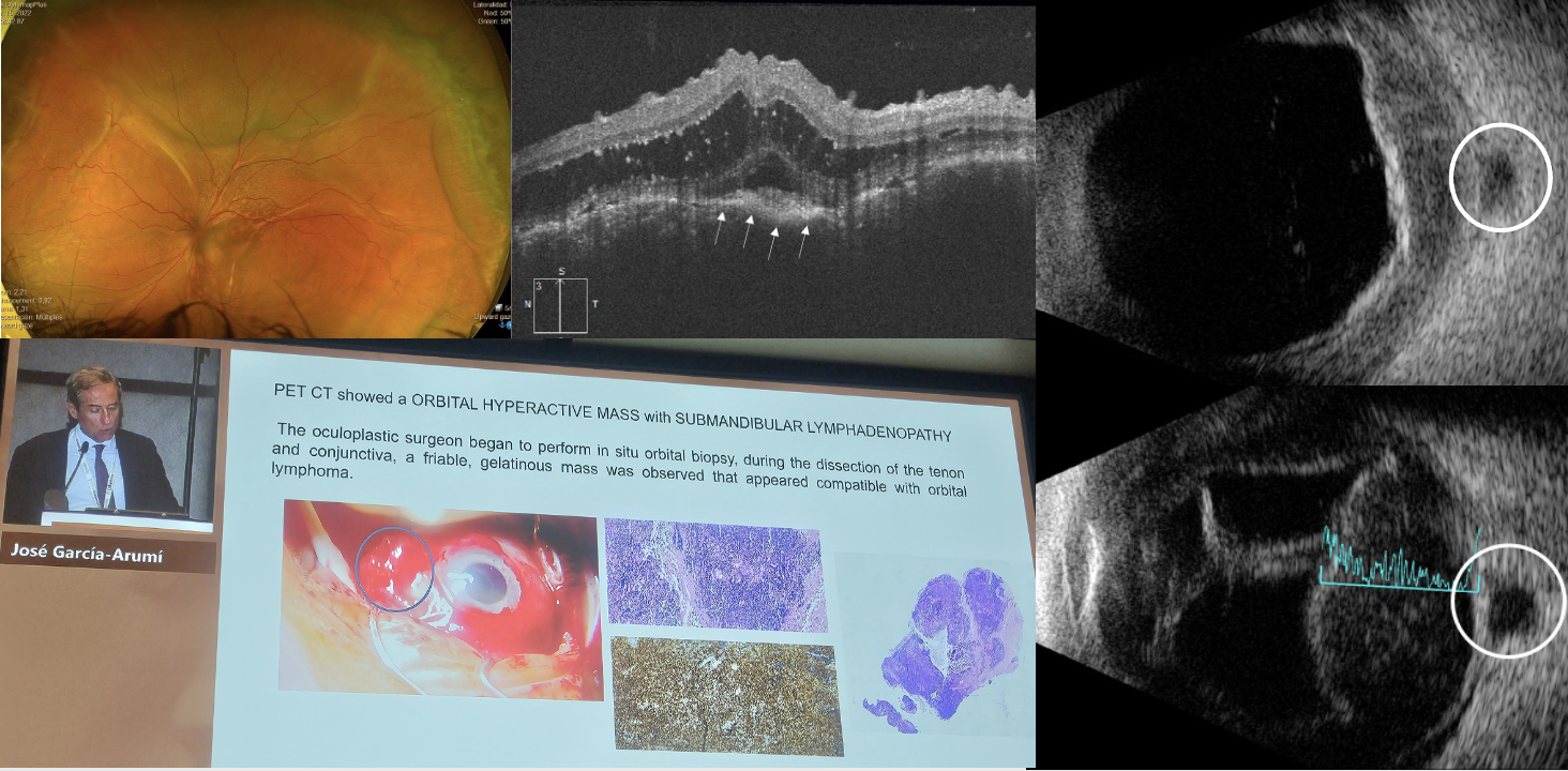 Immagine che contiene testo, schermata, lastra dei raggi X, arte Descrizione generata automaticamente